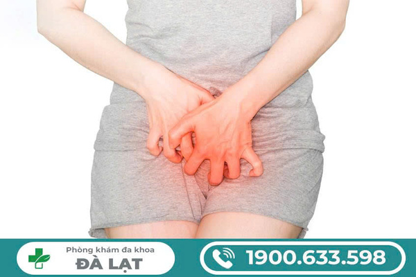 Hình ảnh minh họa